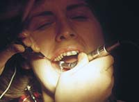 el peligro de las endodoncias